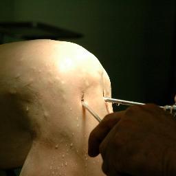 Focused in musculoskeletal business, trends, future.  Extremities, sports med, capital equipment.