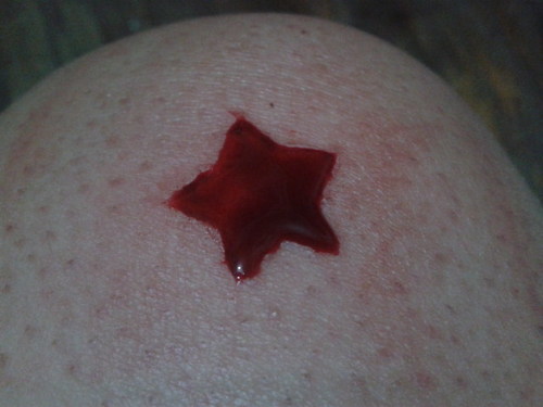 Self harmer, depression. A.S.I, useless, fracasada hasta la muerte. I hate my self and i want to die.