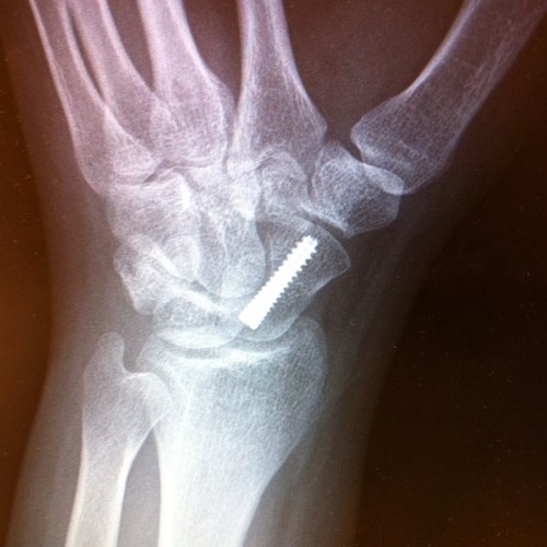 Squish11dejr88's profile picture. Philadelphia Phillies, US WNT Soccer Team, NASCAR (#9, #6, JR Motorsports) Penn State, Go Birds 🦅, music, movies, traveling, and yeah some other things.