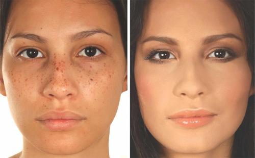 CoverdermIndo's profile picture. We are the official twitter account of Coverderm Indonesia and We are here to help you get your flawless skin. Your solutions for skin imperfections.