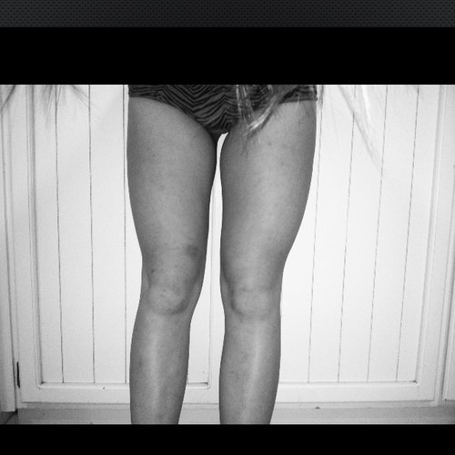 fifteen. anarexic. bulimic. self harm addict. just want to feel beautiful. CW: too fat GW: 125 UGW: 110. follow me and i'll followback(: