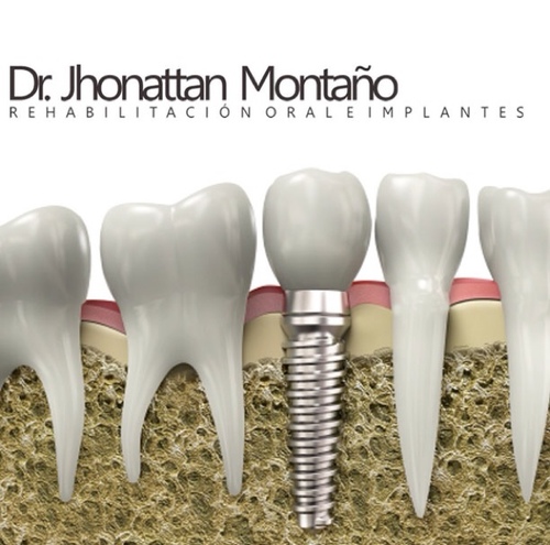 Odontólogo Especialista en Rehabilitación Oral e Implantes. Universidad El Bosque Bogotá. Laboratorio Dental Tecnología Dental Santo Tomas