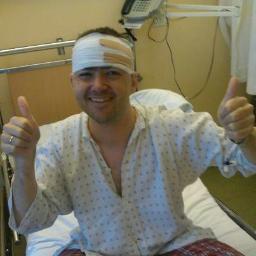 30 year old 4 craniotomies,  2 gliomas,  3 neurosurgeons, 2 countries, 2 years  1 God  No Burzynski jDiagnosed with possible grade 4/3/2 mix gnow grade 2!!