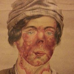 Bad humbug