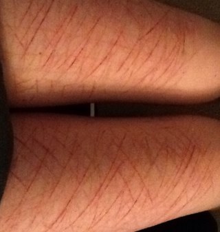 Painfullyempty's profile picture. i hate me. but hey! maybe ana can save me? i just need to be thin, or at least die trying. DM me anytime UGW:thin enough to dance between the raindrops