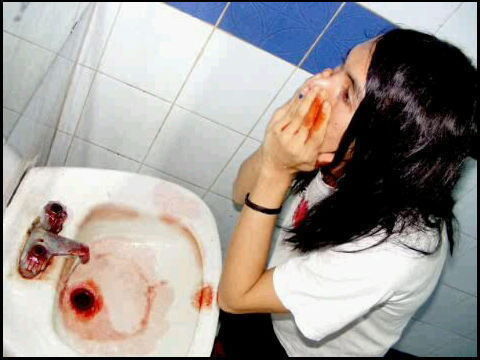 Razorblade