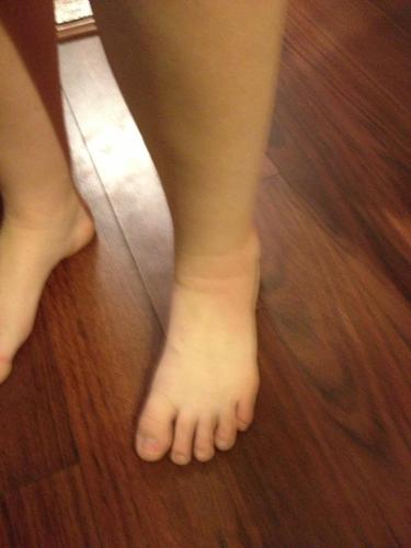 I live on @KristenAller'z ankle thanks to a bug that bit her. I live for swelling and making Kristen's life mizzzz. I'm pretty awesome. for realzzz.