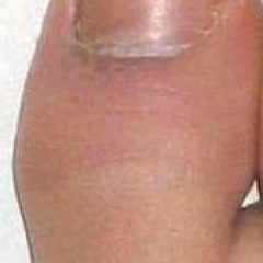 simple_toes's profile picture. had an american online but the speed was slow so im with verizon now, i like to travel with friends and i got my webcame now so gonna show all the hot spots