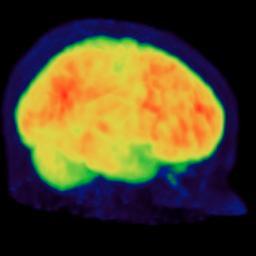 Miguel Servet Researcher in Translational Neuroimaging at IdISSC (Madrid)