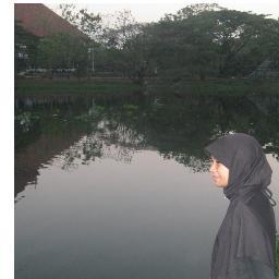 Dentistry Hasanuddin University