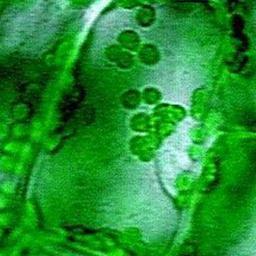 Votechloroplast's profile picture. WITHOUT US, THERE WOULD BE NO YOU!! CHLOROPLASTS FOR LIFE!!!