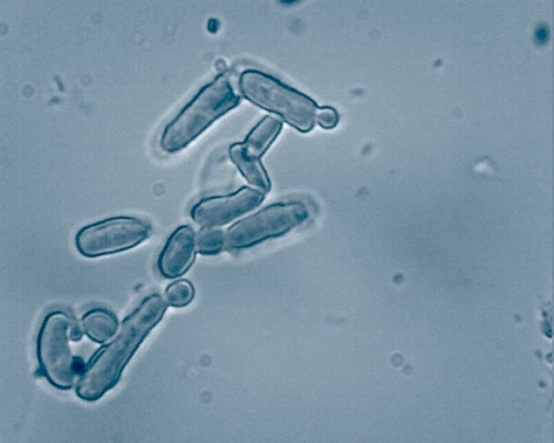 BKYeast's profile picture. My name is Dmitri and I’m just a guy who lives in Brooklyn, enjoys homebrewing and likes biology a little bit.