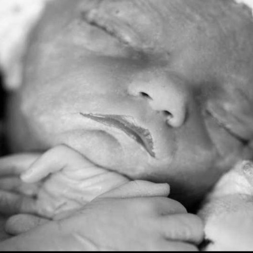 We provide memorial blocks to families who have lost a baby to PAIL as well as direction and support in surviving the loss of a child.

Maura Lynn Shafer