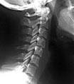 Capuli Chiropratic & Acupuncture is a leading chiropractic clinic in the DFW metroplex. Check us out online!