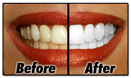 We specialize in teeth whitening.  Our product is all natural with an organic mineral base.  With immediate results!