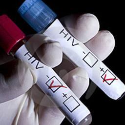 Discover how HIV is a horrific fraud based only on a press conference, some altered lab files and government collusion.