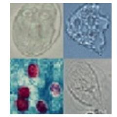 Area of Parasitology. University of Zaragoza. Research in parasite molecular epidemiology, diagnostic, water analysis and depuration processes. IUCA.
