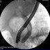 Endoscoping (@endoscoping) Twitter profile photo Endoscoping (@endoscoping) Twitter profile photo