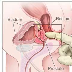Tantra Prostate Massage for Men´s Health and sexual well-being, improove Libido, your Sexlife with ultimate Orgasms through professional Massage Therapist
