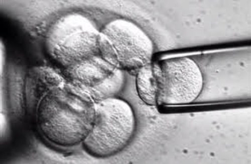 Ginecologia y Reproduccion Humana