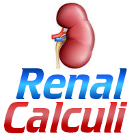 http://t.co/U0kO9Dec - Absolutely everything you need to know about renal calculi including the best medical and non-medical treatments.