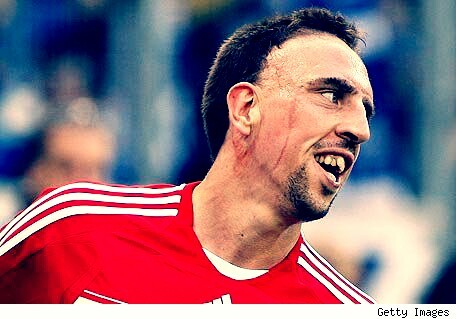 Soy extremo titular del Bayern de Munich y de Francia. Guapo entre los guapos. A extremo regalado no le mires los dientes. (Parodia)