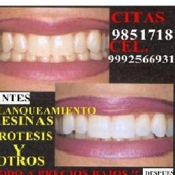 jordia112's profile picture. Consultorio y lab. Dental Diaz y contamos con unidad movil vamos donde nos requieran http://t.co/0FH4InGc: (01999)9851718 cel: 9991642289 merida yuc.