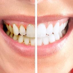 At Asheville Family Dentistry in Asheville, NC, we offer dental implant restoration, cosmetic dentistry, children’s dentistry, one-day Cerec crowns & more.