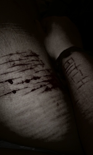 selfharm ¦ sixteen ¦ lesbian ¦ i don't want to be fat anymore ¦ #thinkskinny ¦ don't follow if you do not selfharm. *ifollowback