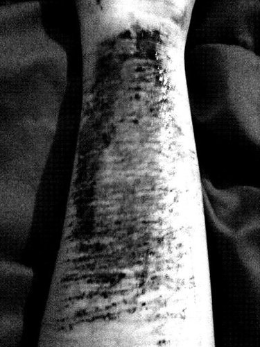 SelfxxMutilatio's profile picture. wish i was someone else.