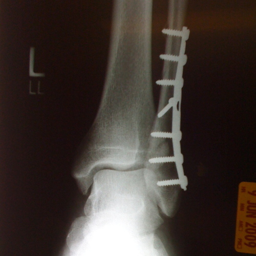 naptownchris's profile picture. Parent, sort of skateboarder, occasional punk rock guitarist, fan of professional wrestling. God damn how do they rock so hard?