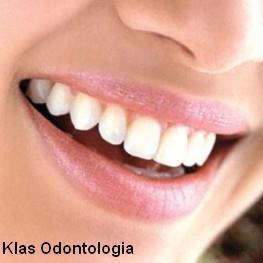 KlasOdontologia's profile picture. Consultório Odontologico - Dentista responsável Dra. Alessandra Goloni CRO/SP 64363