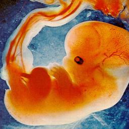 WombPiggy's profile picture. 