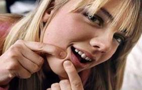 Ya no mas acne!!