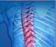 Annual London Imperial Spine Course Spinal Tumours , Royal College of Surgeons of England, London. 6-8 March 2013