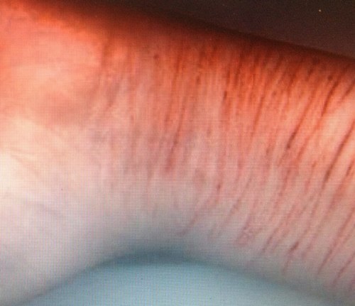 hate_my_skin's profile picture. 