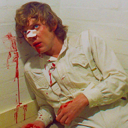 Viddy well, little brother. Viddy well. | A Clockwork Orange | RP |
