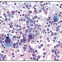 OnkologieNews (@onkologienews) Twitter profile photo