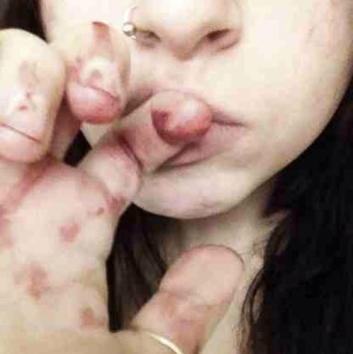 Blackened__x's profile picture. I play bass and sing. Photography and graphic design. Abnormally frightening. I'm the serial killer next door. The epitome of delectably vile.