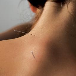 Natalie Saunders LicAc - acupuncturist and writer - lover of all things TCM!