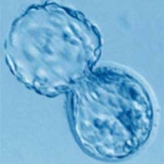 LullabyLull's profile picture. After 3-year fertility quest, IT finally happened: pregs after successful mini-IVF. Every day is a miracle. Grateful for the wonderful support & networks in NYC