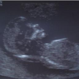 LittleJoandLuke's profile picture. From womb to birth, to life on the outside!