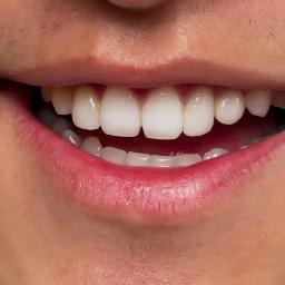 Hey everyone i,m keenly interested in dental care, dentists & bad breath cos it is more important than we realise :)