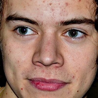 Niall Horan is Ugly. (@NiallIsUglyOk) / X