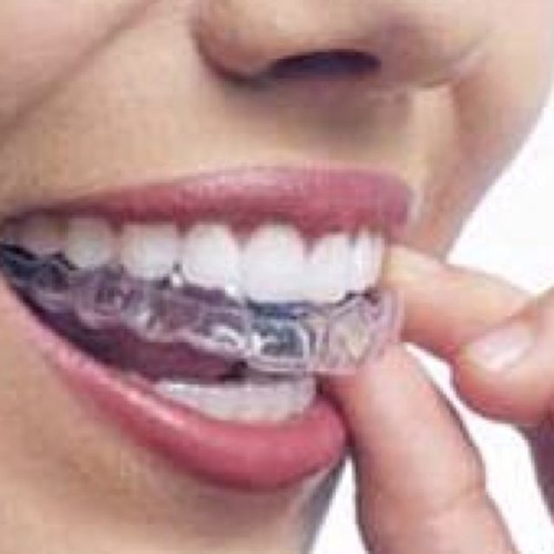 Retainer__Probs's profile picture. Just tweeting some of the problems that we all have with our retainers. If you have braces, follow our other account. @Braces__Probs
