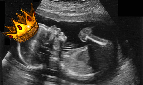 Heir to the heir...Don't hate. Prostrate.

#PrinceWilliam + #KateMiddleton = #RoyalBaby