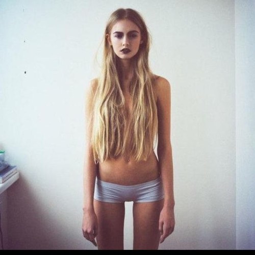 Im_Anorexic's profile picture. 