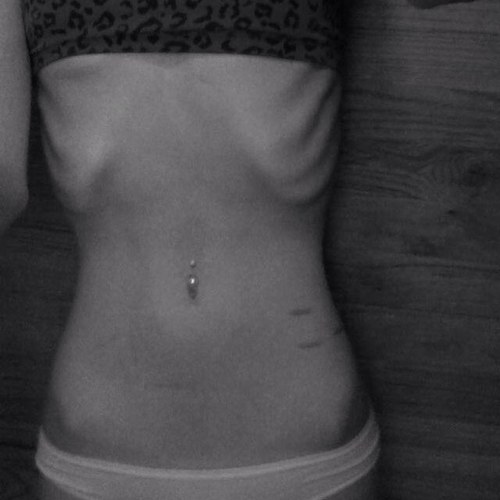 16. Starving for perfection. Cutting the pain away. 5'5 SW: 158 CW: 162 GW: 120 UGW: 100