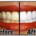 Teeth Whitening (@whiteteethhull) Twitter profile photo