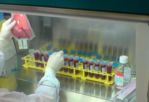 Research Scientist at St Vincent's Hospital in Sydney. Interested in Haematology (Platelets and Haemostasis) and Phlebology, Dermatology and Fluid Mechanics